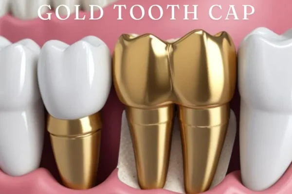 Gold Tooth Cap